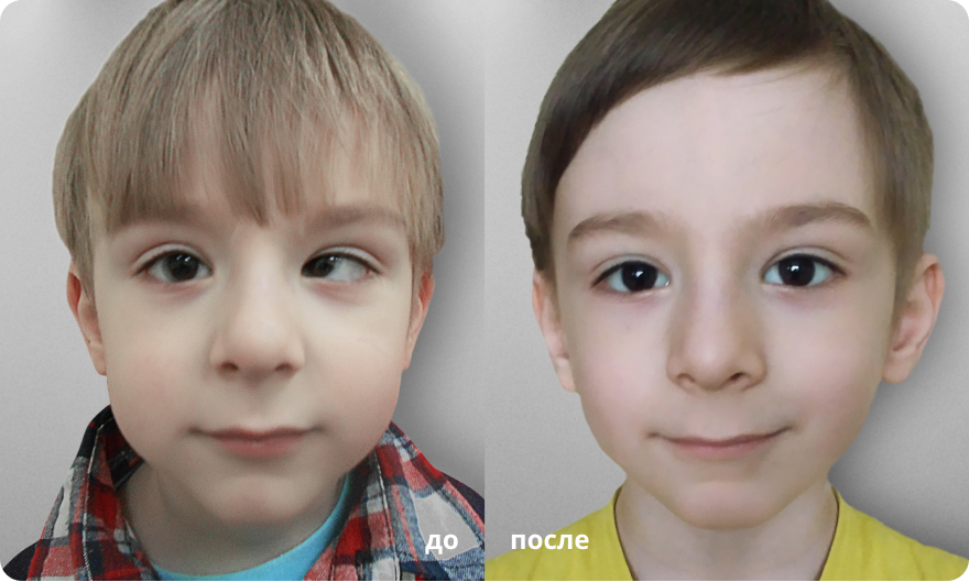 Коррекция зрения в клиниках “Ясный Взор” photo_2