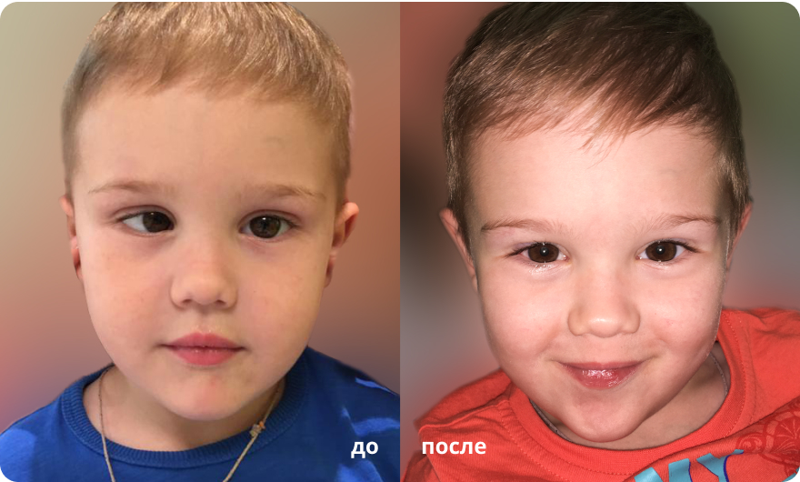 Коррекция зрения в клиниках “Ясный Взор” photo_3